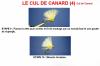 LE CUL DE CANARD (4)